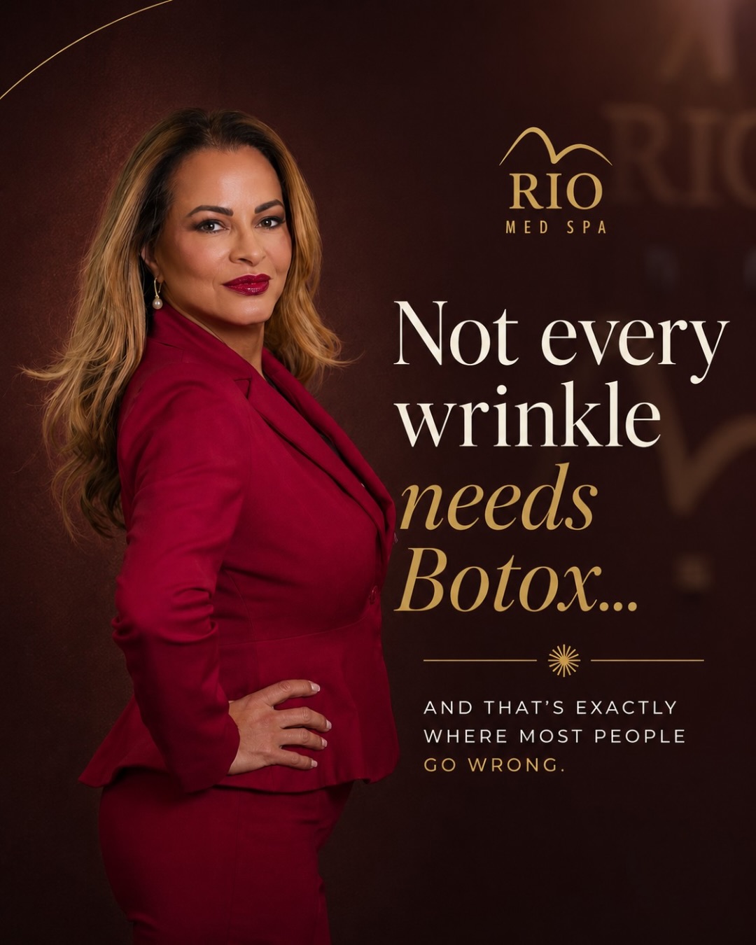 Rio Med Spa editorial post: not every wrinkle needs Botox